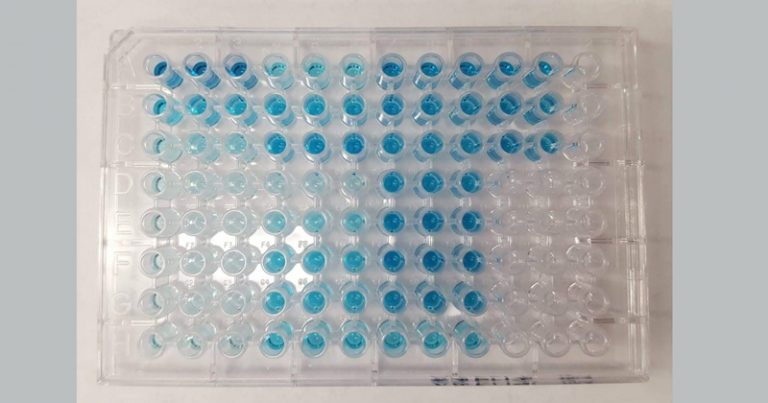 Teste do tipo Elisa, sigla em inglês para Enzyme-Linked Immunosorbent Assay – Foto: Wikimedia Commons